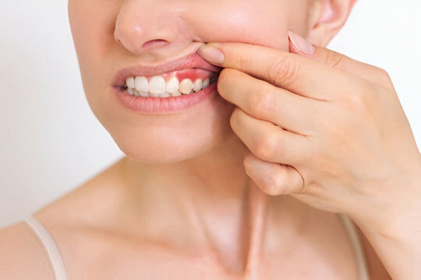 Periodoncia Periodoncia